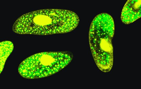 A microscope image of Paramecium bursaria